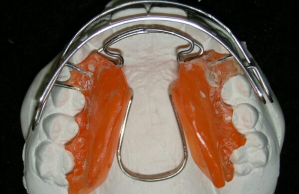 fig4cimadireita-800×521