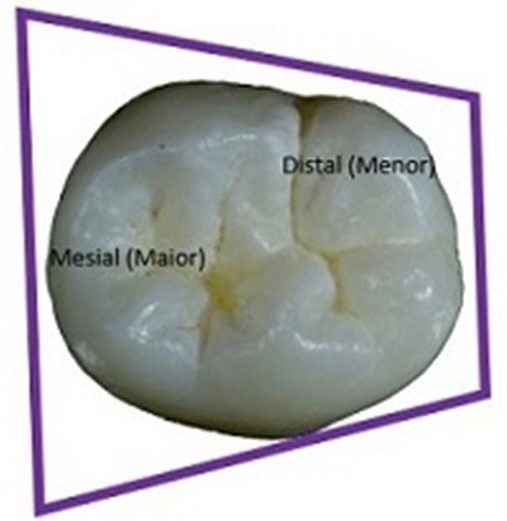 Entendendo A Anatomia Do Primeiro Molar Inferior – MarketPlena