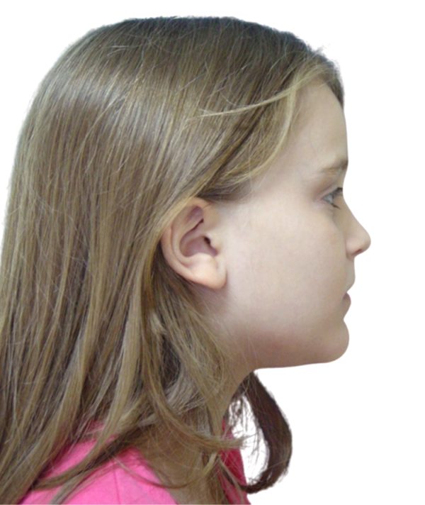 Fig. 1A