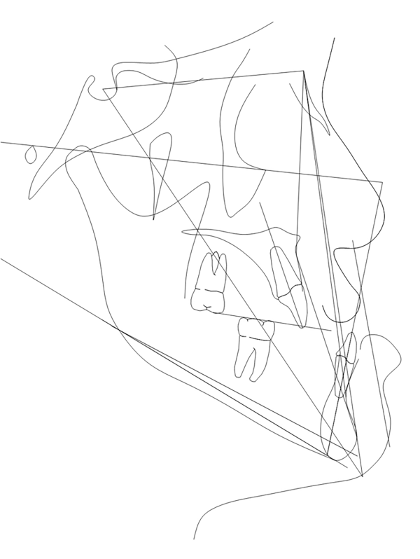 FIGURA 1A