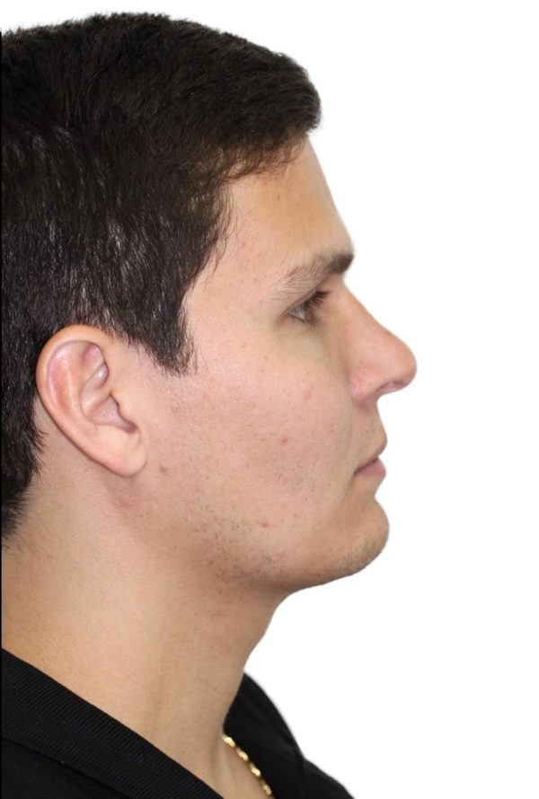 Figura 1a